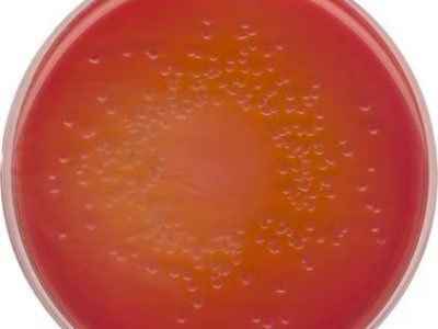 محیط کشت آگار مک‌کانکی, MacConkey Agar , 105465, خرید محیط کشت آگار مک‌کانکی