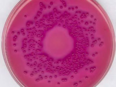 محیط کشت VRBD , خرید محیط کشت VRBD , فروش محیط کشت VRBD , VRBD (Violet Red Bile Dextrose) agar , 110275