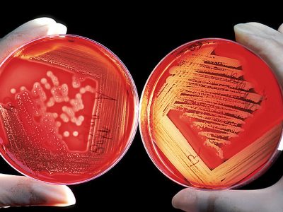 محیط کشت بلاد آگار, خرید محیط کشت بلاد آگار, Blood Agar, 110886